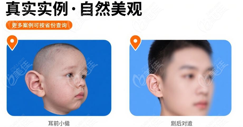 深圳 & 广州：华南地区耳再造实例多医生信息