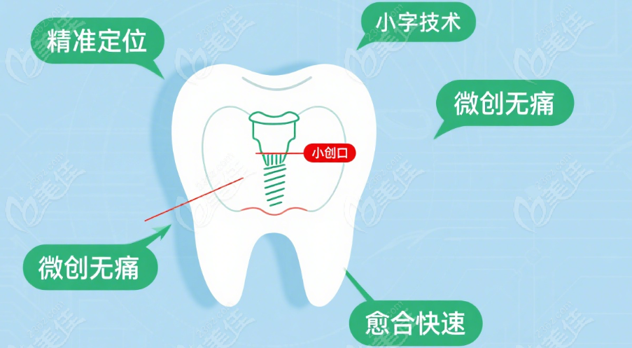 臨海頂新口腔種植牙價(jià)格 3980 起