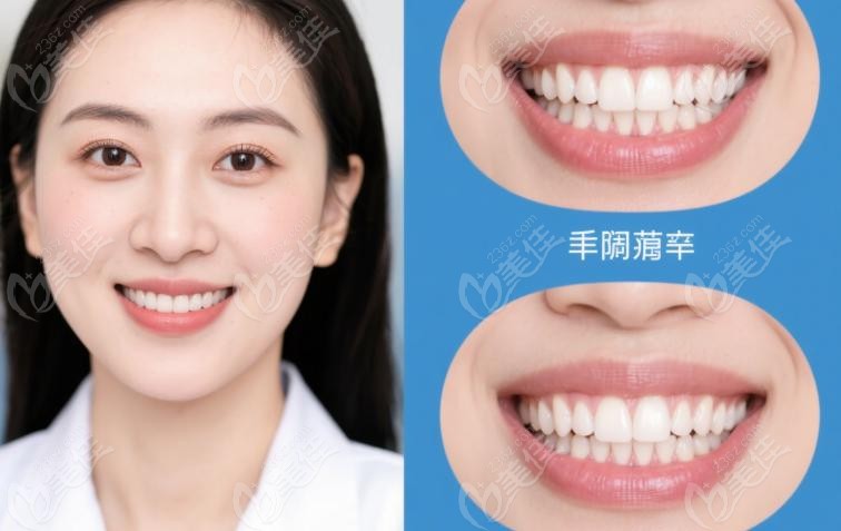 徐宝华团队刘若曦医生审美密码