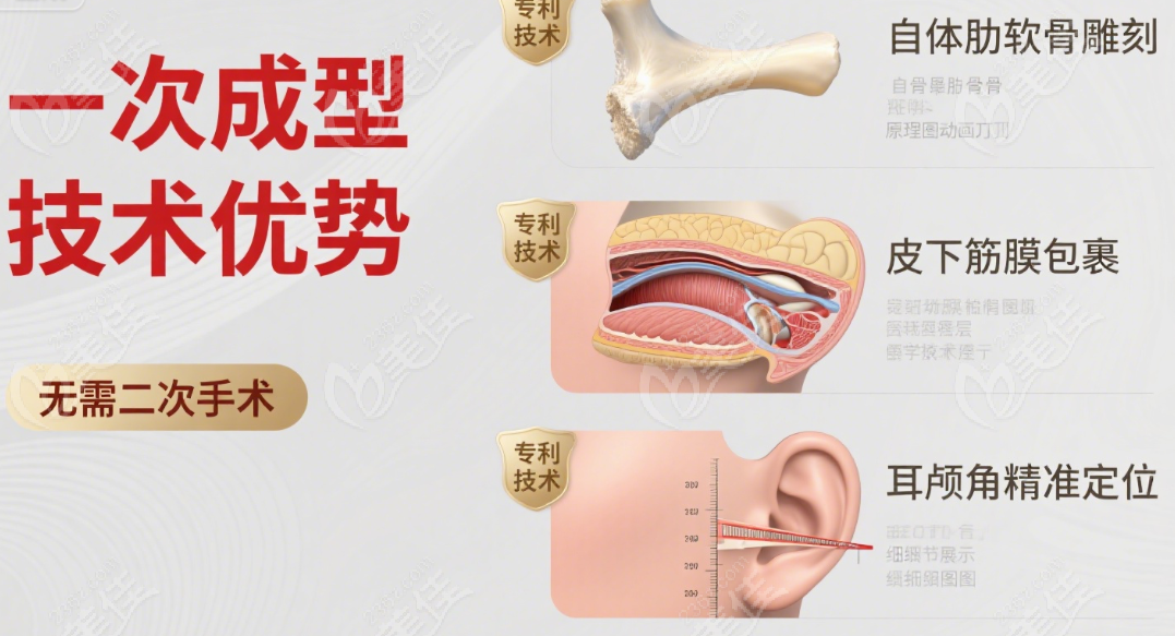 吴建明全耳再造技术原理