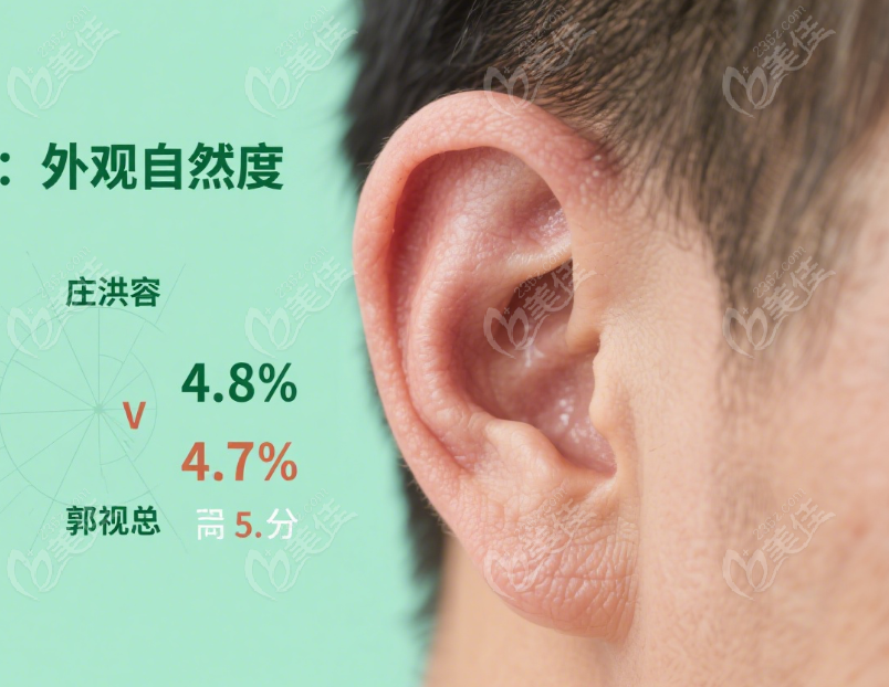 庄洪兴外耳再造成效好