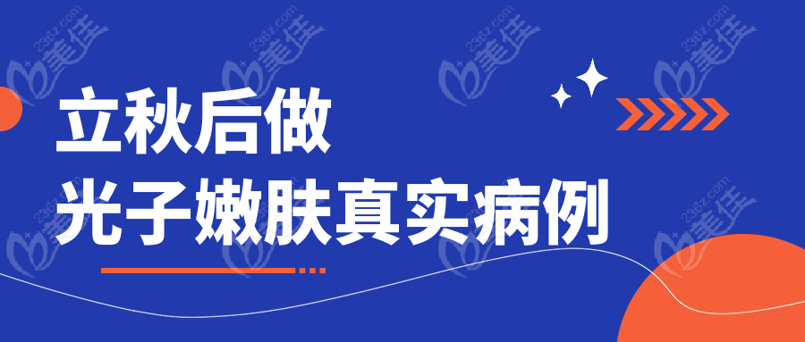 立秋后做光子嫩肤真实病例