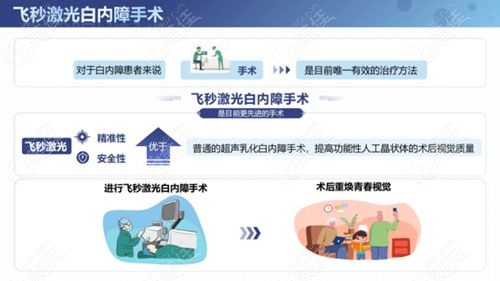 飞秒白内障手术3.jpg
