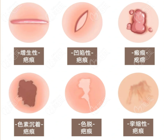 谷培俊醫(yī)生口碑
