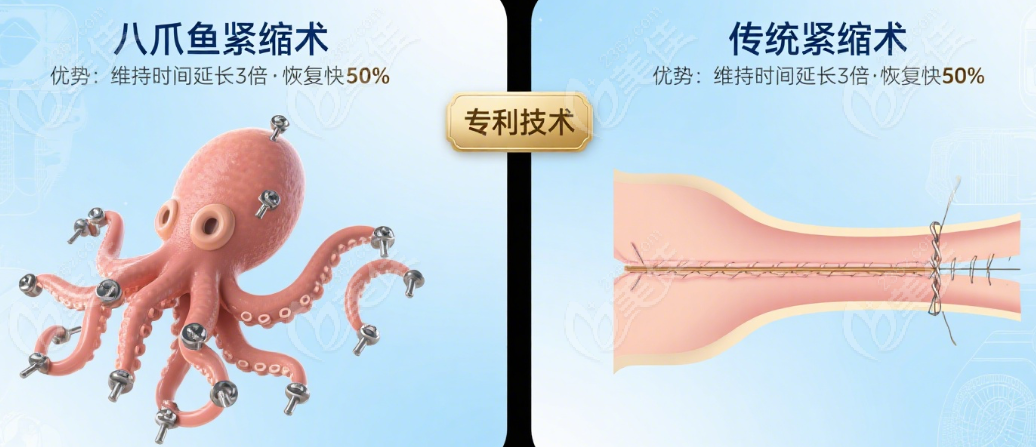 上海整形医院3D生物束带对比实测