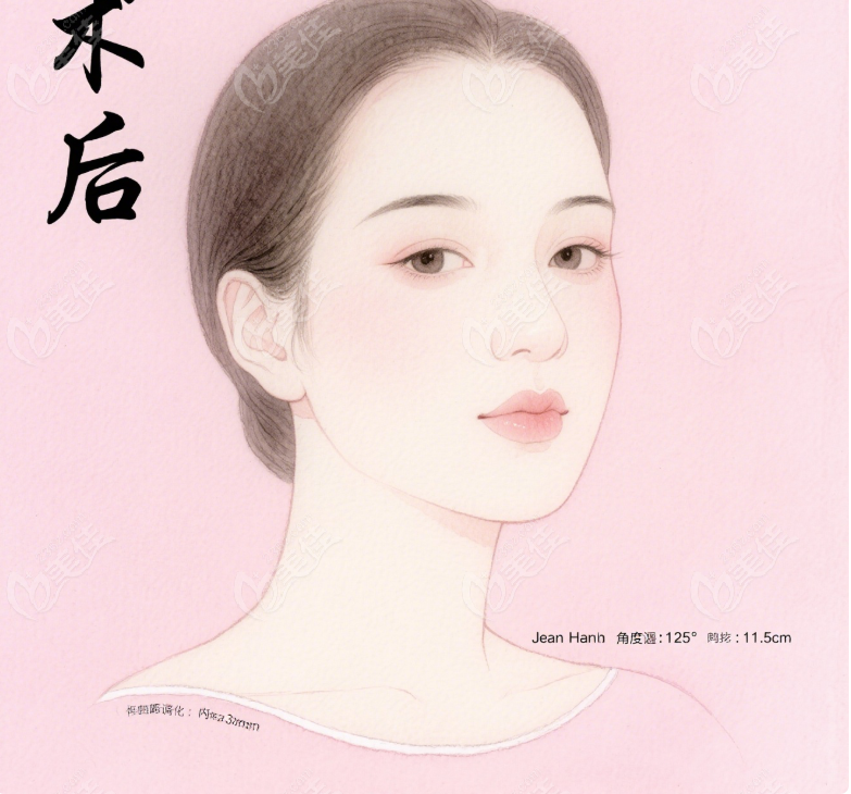 广州朴正国医生手术价格表
