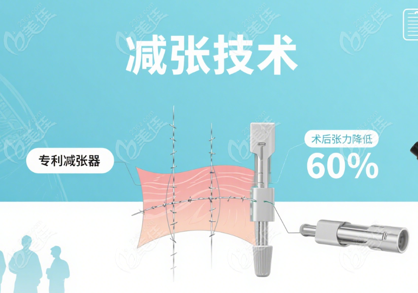 陳立彬魚骨減張技術(shù)