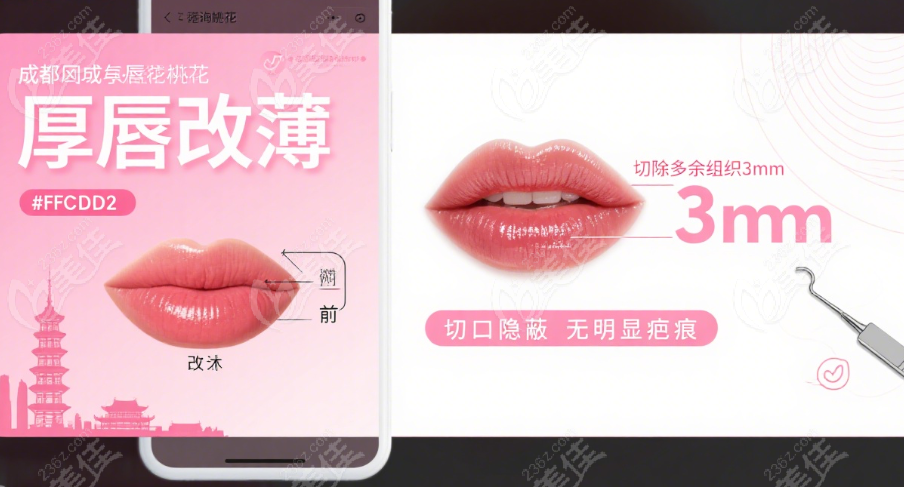 赵久丽厚唇改薄病例