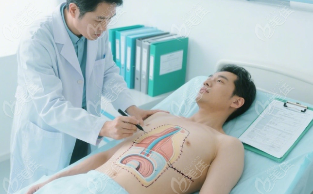 腹壁成形手术报销吗