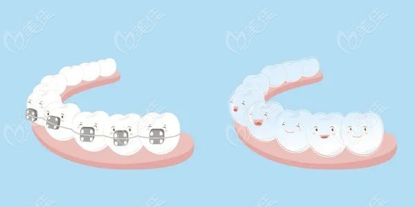 杭州口腔医院德清分院正畸价格