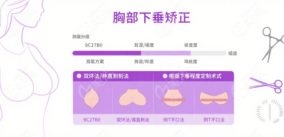 济南乳房悬吊术
