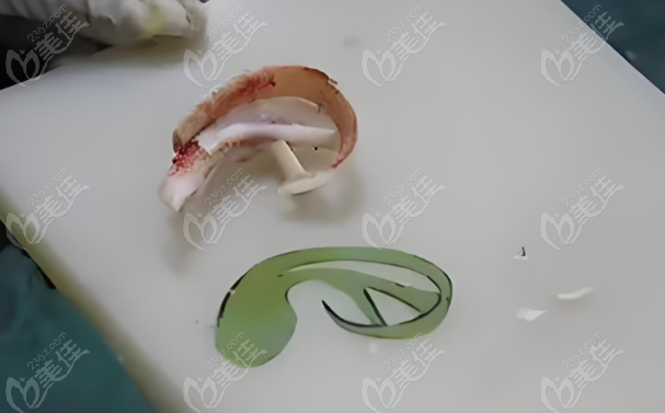 降低麻醉风险的3个关键www.236z.com 降低麻醉风险的3个关键www.236z.com