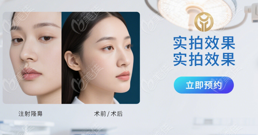 上海陈向东注射隆鼻成效好