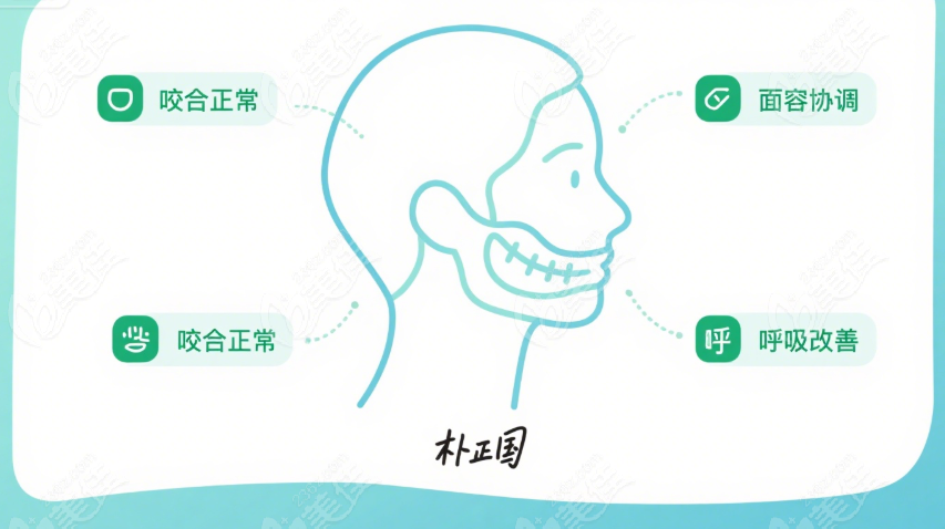 樸正國(guó)正頜手術(shù)實(shí)例