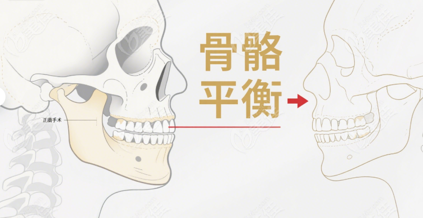 鄭廣森正頜手術(shù)技術(shù)怎么樣