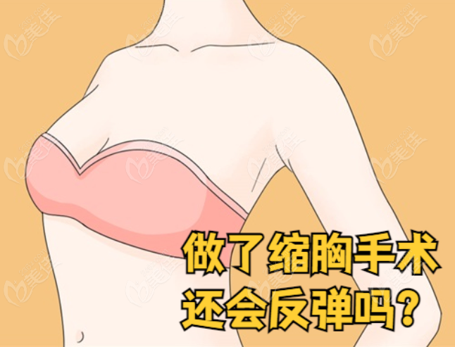 劉巍醫(yī)生一臺靠譜的縮胸手術如何實現(xiàn)