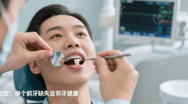 钦州哪家医院做马里兰桥好236z.com