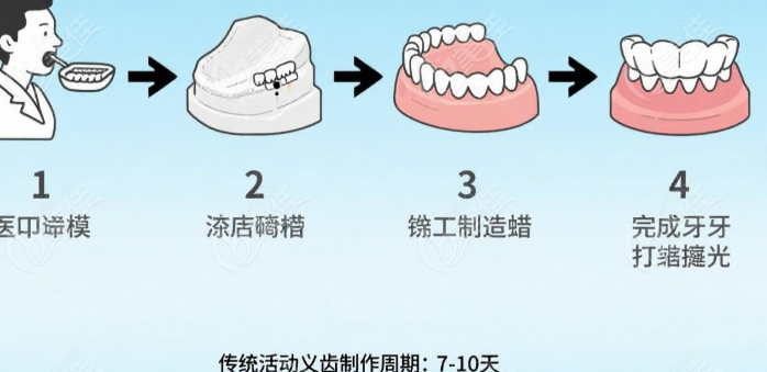 汉中市口腔医院吸附性义齿