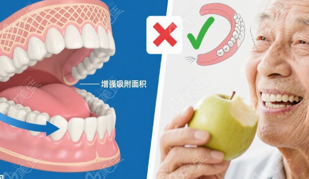 汉中市口腔医院老人满口假牙