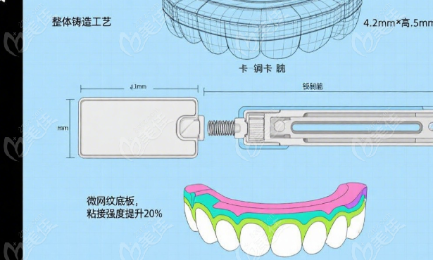 普特自锁托槽怎么样