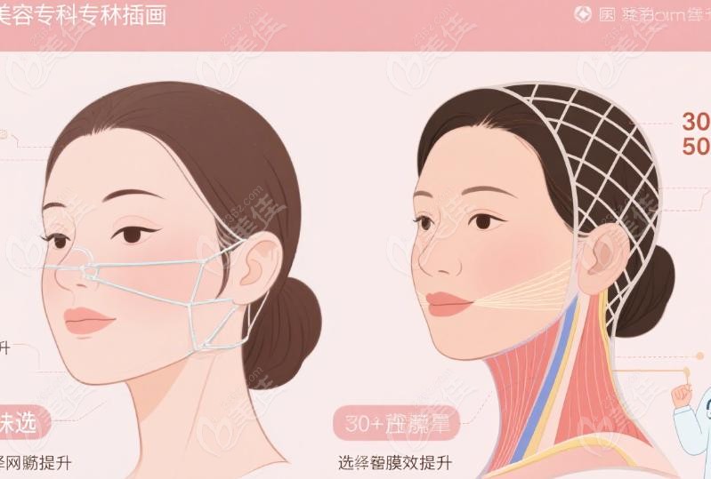 网兜提升和筋膜提升哪个成效好