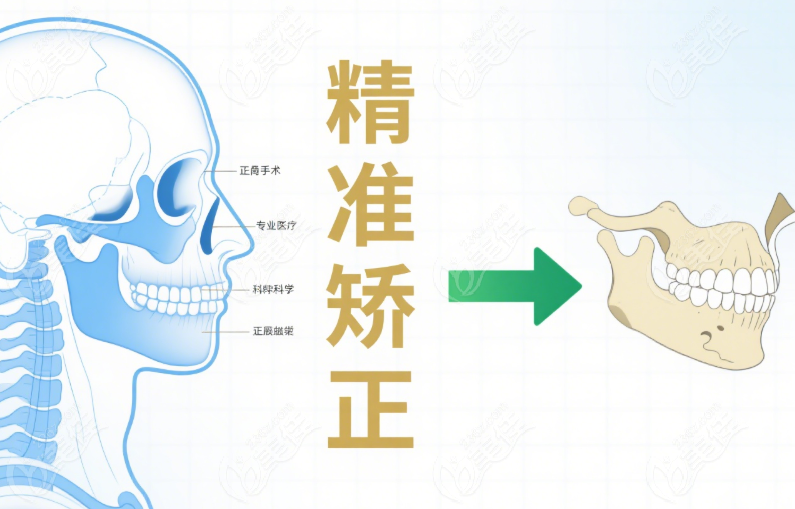 精细的正颌技术