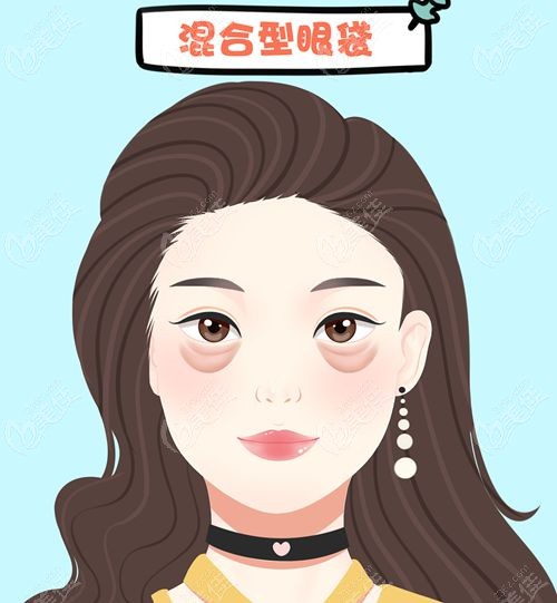 无锡去眼袋正规医院排行榜前十