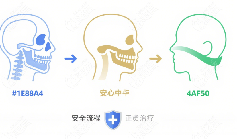 鄭廣森正頜手術(shù)提高預(yù)約的小竅門