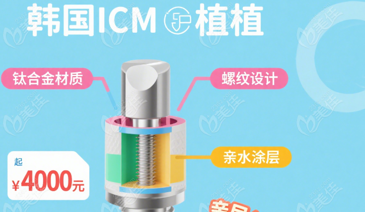 ICM种植体价格