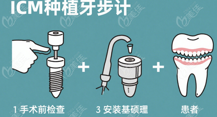 ICM种植牙怎么样