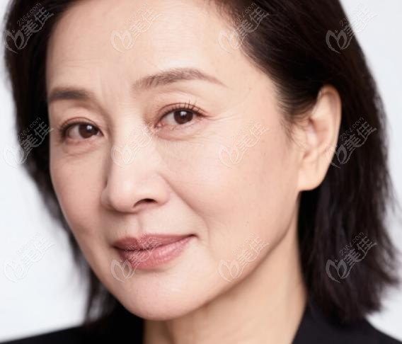 48岁打塑妍萃还是艾维岚？对决战