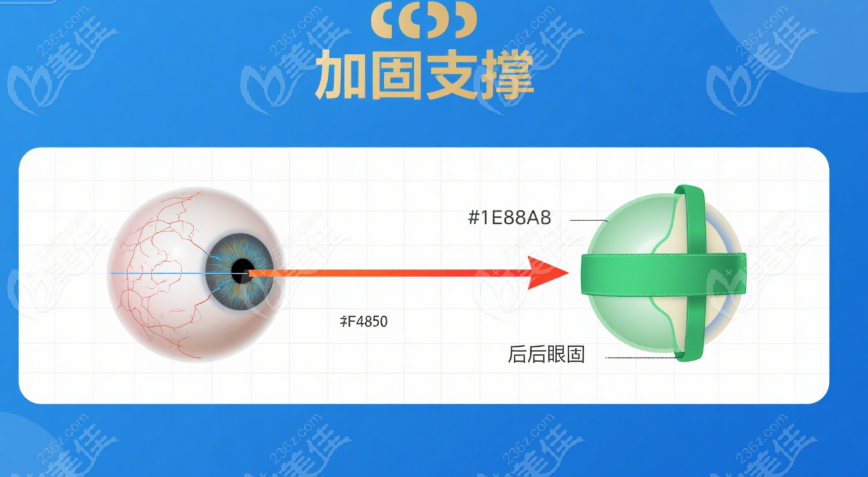 后巩膜加固术做得好的医院 预约流程与注意事项www.236z.com