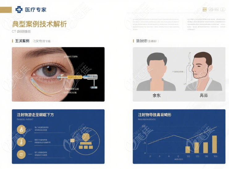 鼻子不明注射物取
