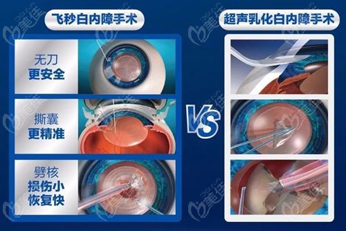 无锡白内障手术费可以报销