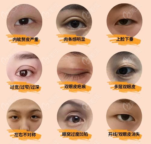 广州潘贰修复失败实例分享