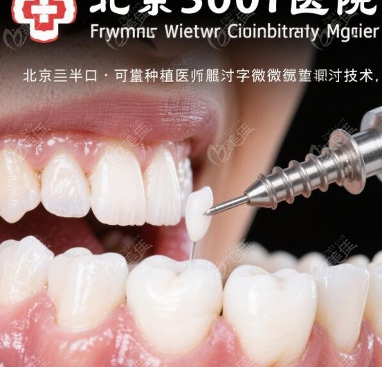 北京301医院种牙可靠吗？术后护理与长期维护建议