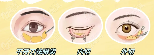 三亞華美去眼袋主刀醫(yī)生曝光