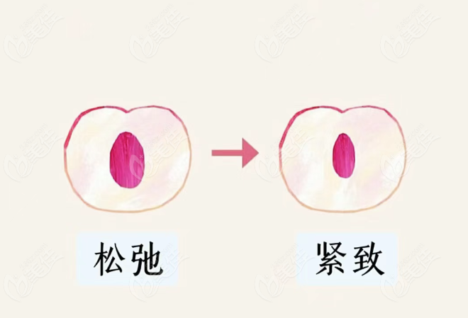 沈陽京科醫(yī)院私密緊縮術(shù)價目表