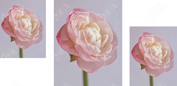 沈陽京科醫(yī)院私密緊縮術(shù)