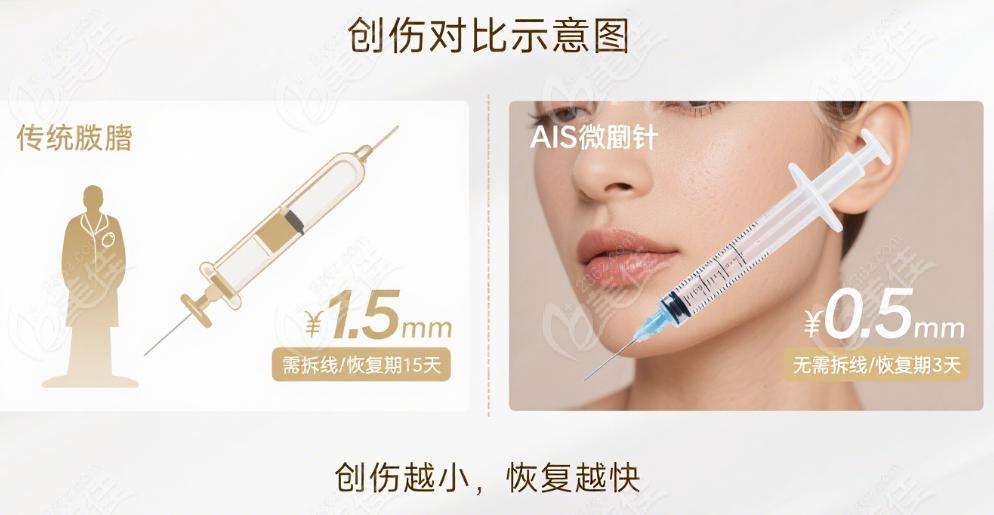 潘红伟面部吸脂顾客评价
