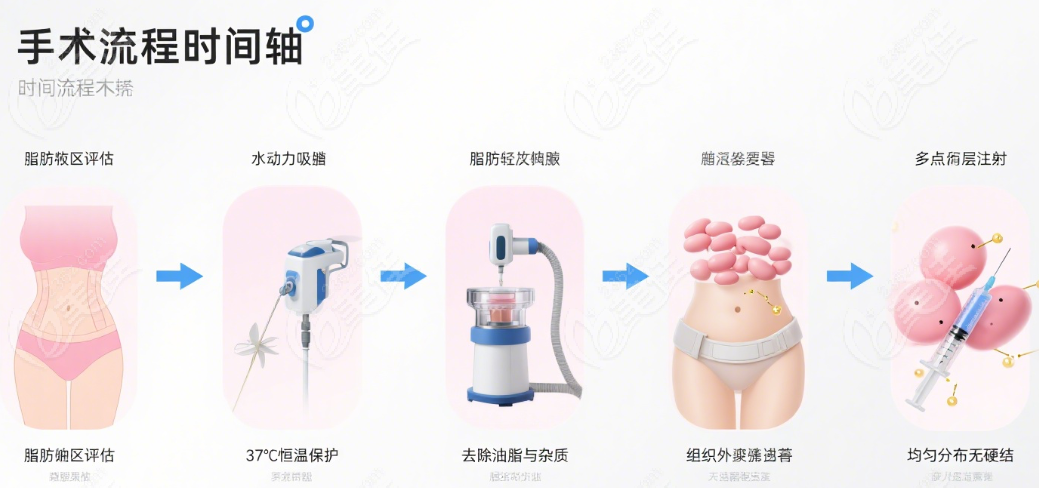 栾杰医生自体脂肪乳房重建技术原理