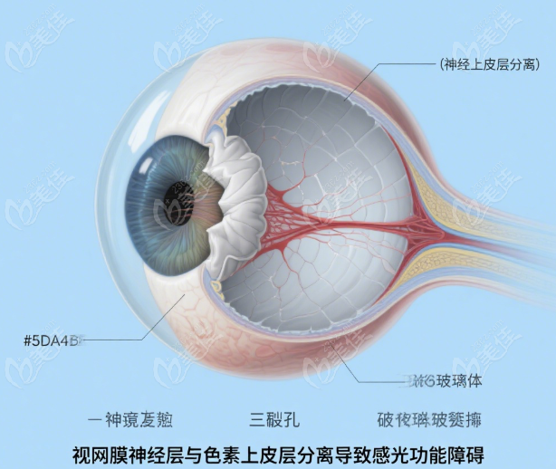 爱尔眼科视网膜损伤手术医生排名前十www.236z.com