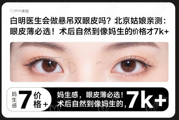 白明醫(yī)生懸吊雙眼皮價格全解析