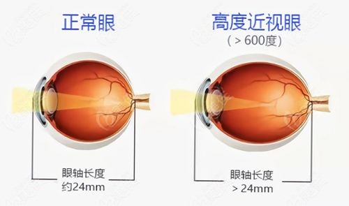 北京同仁段安丽的手术要排多久