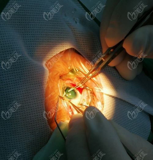 为什么说他“微创+几乎零失败”