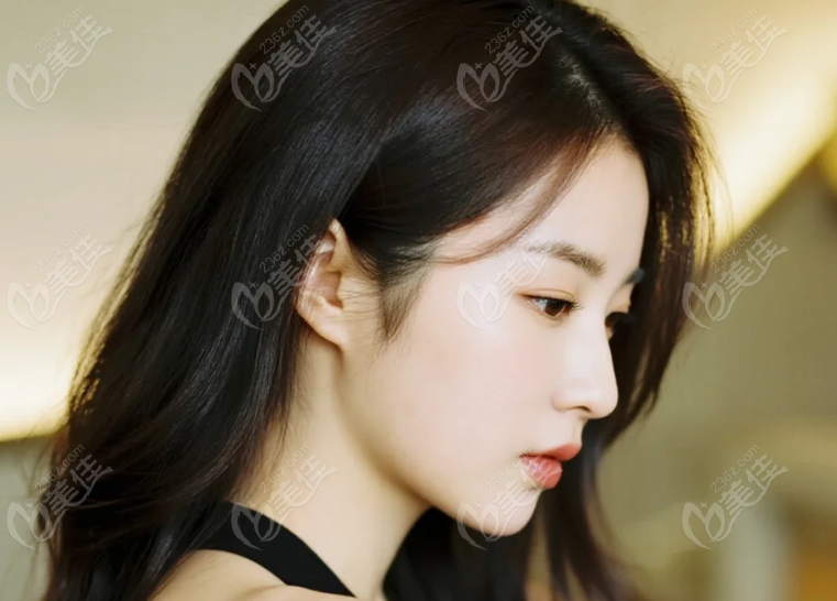 西安大美整形联系刘峰做激光祛斑的优势