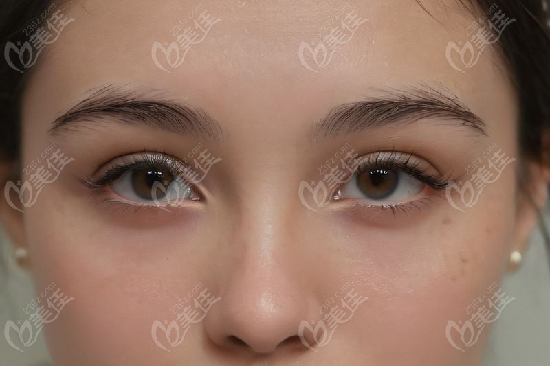 四、贵州医科大学附属医院眼科的优势