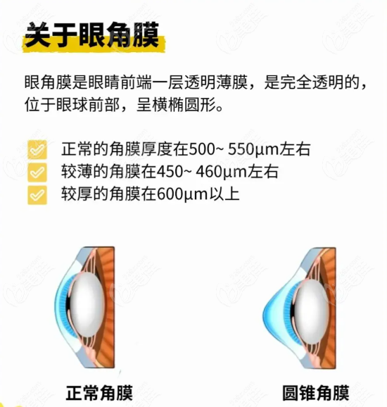 1000度高度近视做全飞秒吗