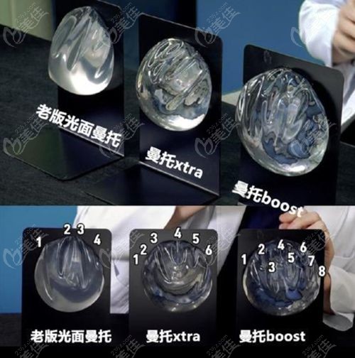 曼托假体的优势