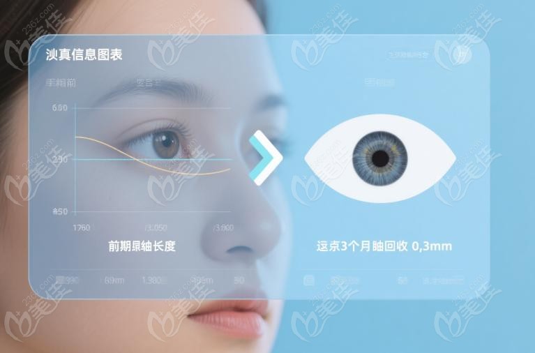 做了后巩膜加固后悔了